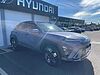 Hyundai KONA 1.6 Hybrid 129 Ultimate 5dr DCT Blue